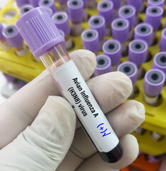 Blood Sample positive for Avian Influenza type A (H3N8) virus test, avian influenza virus (AIV),...