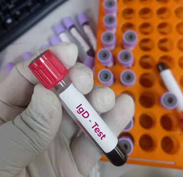 Scientist hold blood sample for IgD (Immunoglobulin D) test. antibody isotype.