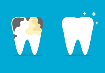Set before after different tooth decay stains to white shiny clean tooth dental cartoon character on blue background icon flat vector design.