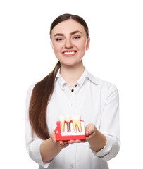 Dentist holding educational model of dental implant on white background