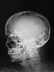 x ray image of human skull