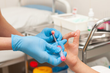 Close-up blood test from a child's finger. Doctor takes blood from a little girl's finger.