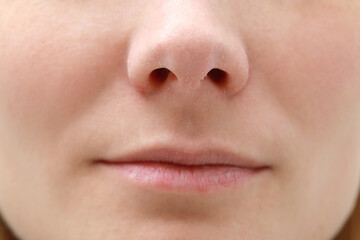 Obraz premium Woman with dry skin, closeup of mouth