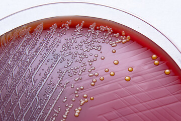 Gram positive cocci growing on gelose with 5 per cent ram blood