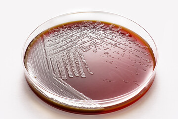 Gardnerella vaginalis growing on casman gelose medium