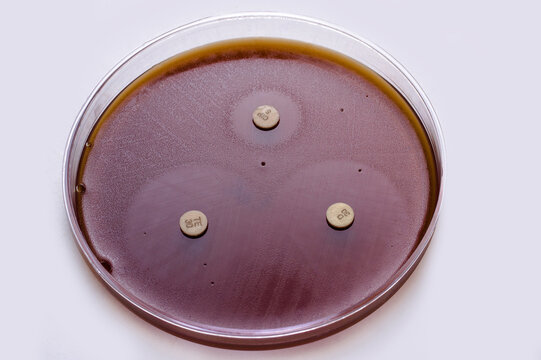 antibiogram of Neisseria gonorrhoeae on GC Agar