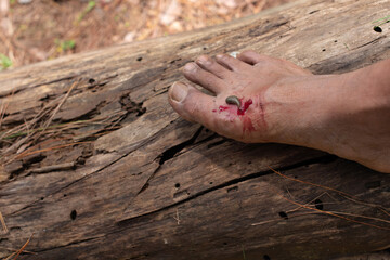 Close up, Leech is biting and sucking blood on male foot while trekking through the forest,...
