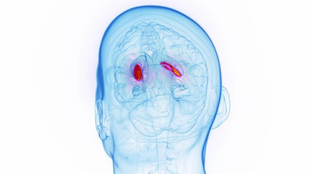 3D medical animation of a man's lateral globus pallidus