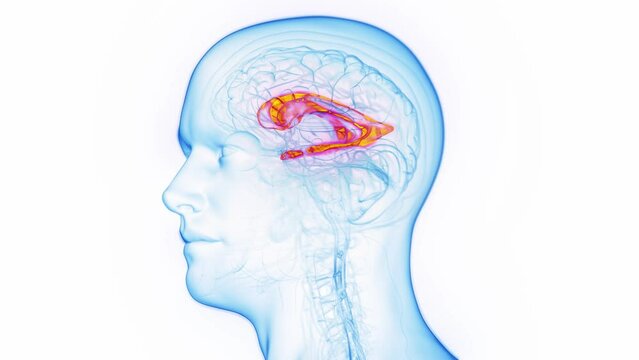 3D medical animation of a man's lateral ventricle