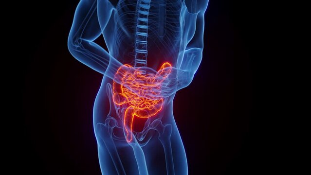 3D medical animation of a man experiencing abdominal pain