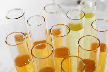 Tubes with urine samples for analysis on blurred background, closeup - obrazy, fototapety, plakaty