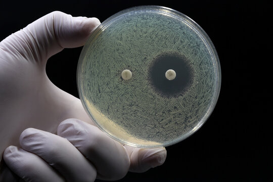 A doctor's or researcher's hand holding a Petri dish with a culture of bacteria on which an antibiotic disc test is performed. Antimicrobial resistance concept
