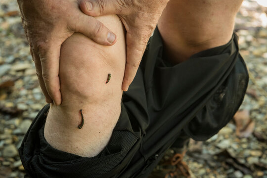 Man stands showing two leeches on his leg, Gunung Mulu National Park; Sarawak, Borneo, Malaysia