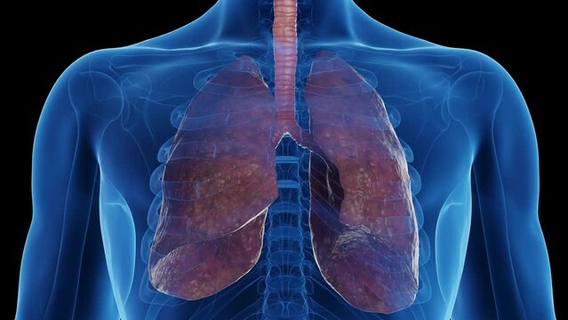 3D medical animation of a man's healthy lungs turning into smoker's lungs
