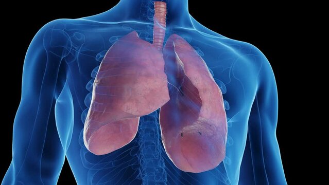 3D medical animation of a man's healthy lungs turning into smoker's lungs