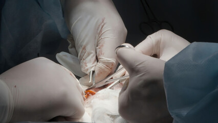 Surgical operation . Action . Young specialists who perform surgery with surgical tweezers, blood and organs that are cut for recovery are visible.