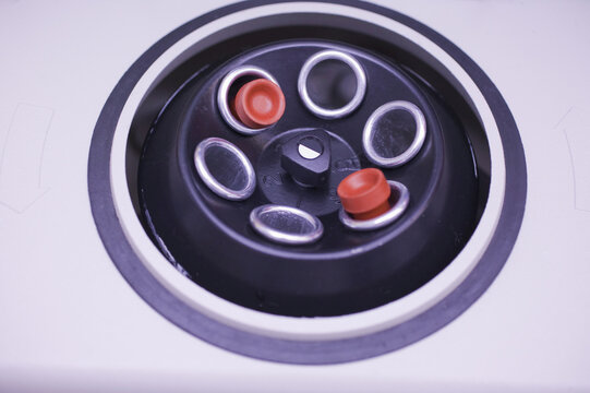 Close-up of medical samples in a centrifuge