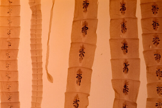 Close view of a broad fish tapeworm (Diphyllobothrium latum), a parasite that can grow up to 35 feet in length within a person's intestine.; United States.