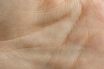 Closeup view of human hand with dry skin