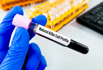 Blood sample for Natural killer cell profile test 