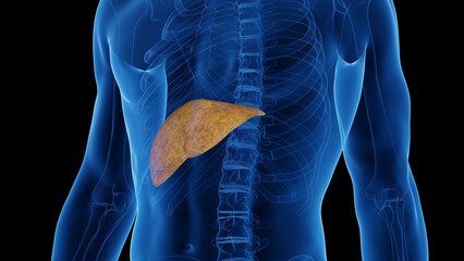 3D medical illustration of a man's fatty liver - obrazy, fototapety, plakaty