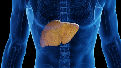 3D medical illustration of a man's fatty liver - 554402330