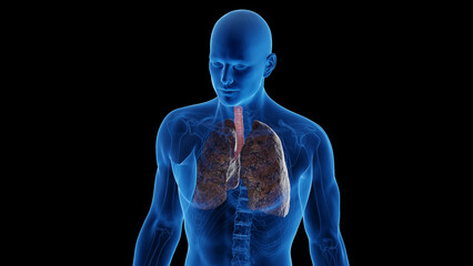 3D medical illustration of a man with smoker's lungs