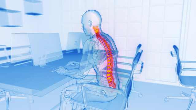 3D medical illustration of a man experiencing back pain at work