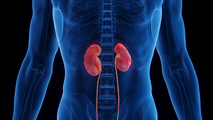 3D medical illustration of a man's inflamed kidneys - 554402546