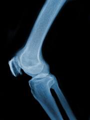 x ray image of human hand