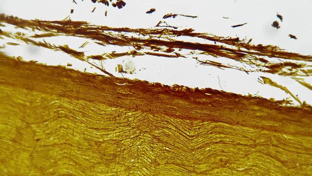 Silvering pattern of human nerves trunk in longitudinal section filmed under microscope 200x on bright field. Isolated macro view of fibers bundle of people nervous system. Studying neurology in lab