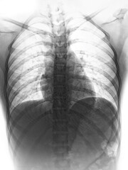 x ray of a human skull with x ray