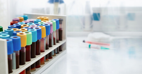 Workbench with tray with blood tests for examine in the hematology laboratory. Workplace Rack with tubes of blood samples from patients in the Clinical Analysis laboratory of the hospital
