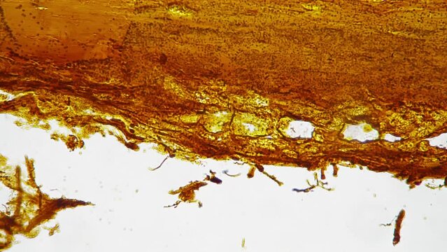 Silvering human nerves trunk in longitudinal section filmed under microscope 400x on white background. Isolated macro view of fibers bundle of people nervous system sample. Studying neurology in lab.