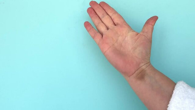 A woman's hand with a hematoma on a blue background. A signal for help is a gesture that can help people experiencing domestic violence.