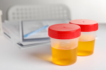 Containers with urine samples on white table in laboratory, space for text. Specimen collection