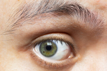 Close-up to a green eye with a mole