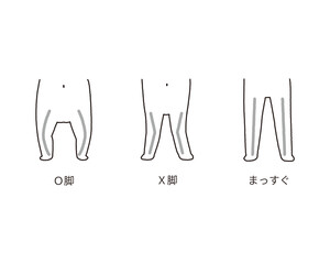 赤ちゃんの脚の形の変化 モノクロ