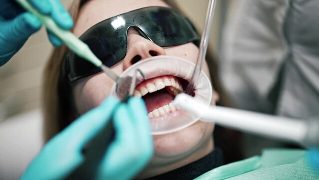 Dentist doctor and assistant pouring water using syringe to clean and wash patient mouth. Woman with glasses and open mouth. Saliva ejector or dental pump to evacuate saliva. Medical equipment.