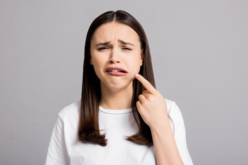 Crying tired sad woman suffers from painful toothache dental illness pointing on teeth standing on...