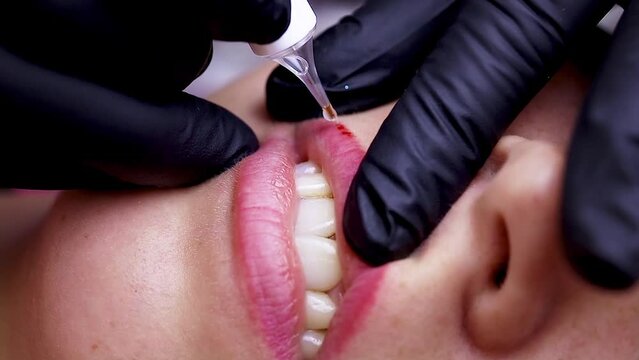 Introduction of an acid remover into the skin of the lips to dissolve the old permanent makeup. High quality FullHD footage
