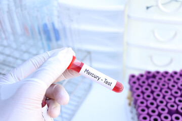 Mercury test to look for abnormalities from blood