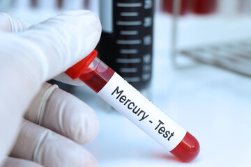 Obraz premium Mercury test to look for abnormalities from blood