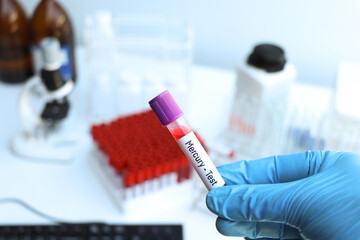 Mercury test to look for abnormalities from blood