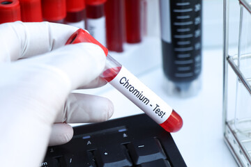 Chromium test to look for abnormalities from blood