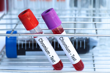 Chromium test to look for abnormalities from blood