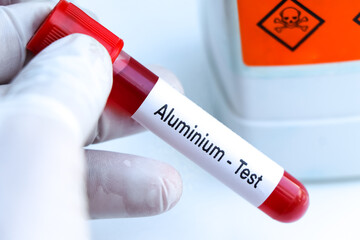 Obraz premium aluminium test to look for abnormalities from blood