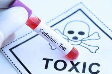 Cadmium test to look for abnormalities from blood