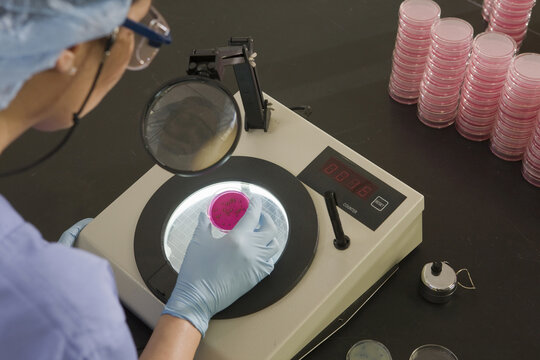 Female scientist examining bacterial colonies in a sample
