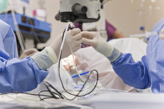 Doctor passing phaco hand piece to technologist during cataract surgery